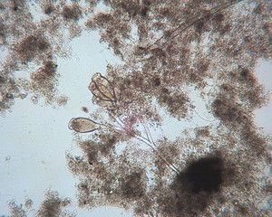 Mikroorganismen und Bakterienmasse im Klärschlamm unter dem Mikroskop